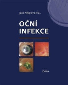 Oční infekce - Jana Nekolová