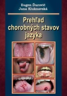 Prehľad chorobných stavov jazyka - cena, porovnanie