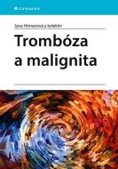 Trombóza a malignita - cena, porovnanie