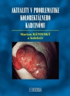 Aktuality v problematike kolorektálneho karcinómu - cena, porovnanie