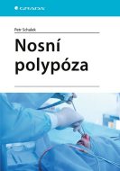 Nosní polypóza - cena, porovnanie