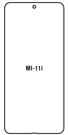 Hydrogel  Ochranná fólia Xiaomi Mi 11i - predná lesklá