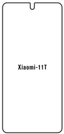 Hydrogel  Ochranná fólia Xiaomi 11T - predná lesklá