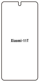 Hydrogel  Ochranná fólia Xiaomi 11T - predná lesklá
