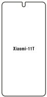 Hydrogel  Ochranná fólia Xiaomi 11T - predná lesklá - cena, porovnanie