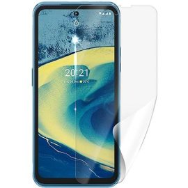 Screenshield NOKIA XR20 5G fólia na displej (NOK-XR205G-D)