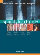 Spondyloartritidy - cena, porovnanie