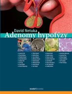 Adenomy hypofýzy - cena, porovnanie