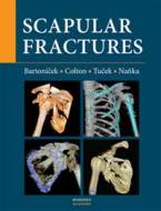 Scapular fractures - cena, porovnanie