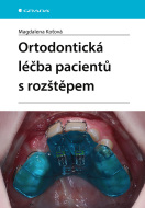 Ortodontická léčba pacientů s rozštěpem - cena, porovnanie