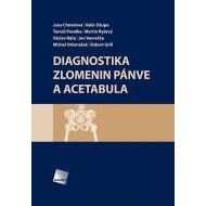 Diagnostika zlomenin pánve a acetabula - cena, porovnanie